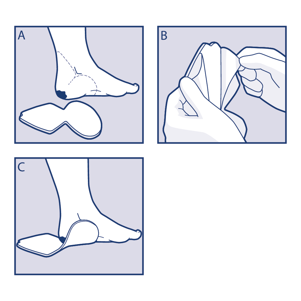 Tres imágenes que muestran cómo seleccionar el tamaño adecuado y aplicar Cutimed Siltec PLUS Heel 3D  Tres imágenes que muestran cómo seleccionar el tamaño adecuado y aplicar Cutimed Siltec PLUS Heel 3D